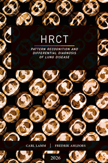 HRCT - Pattern Recognition and Differential Diagnosis of Lung Disease